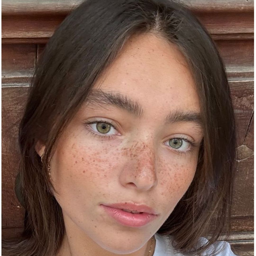 Cuidado Localizado para Manchas Oscuras, Ácido Kójico al 1 %